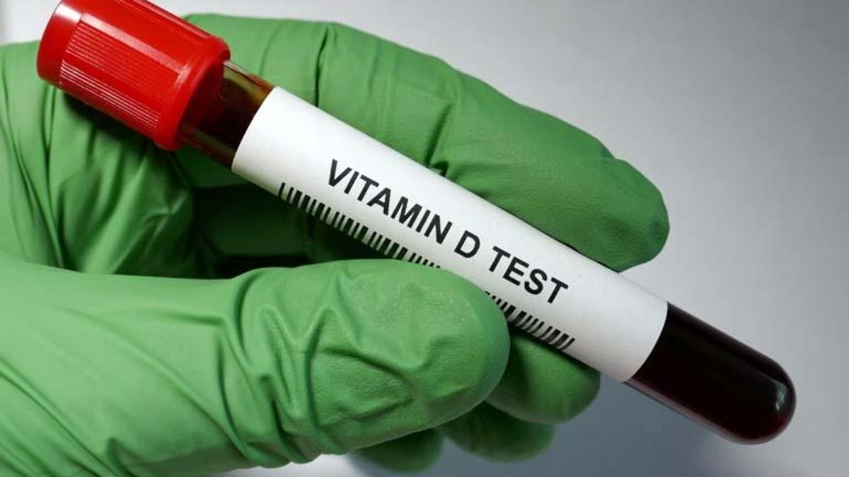 Uzmanı açıkladı: “D vitamini, kemik oluşumu ve gücü için hayati önem taşır”