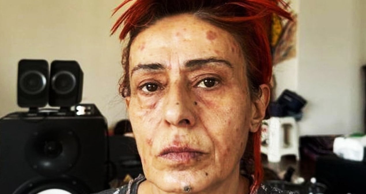 Yıldız Tilbe’den kökten çözüm